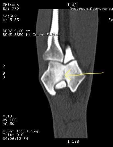 Lexi X-Ray