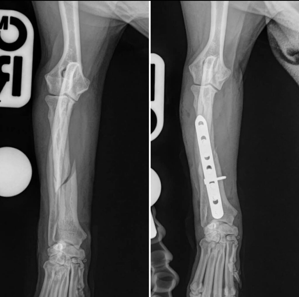 xray of before and after a fracture procedure